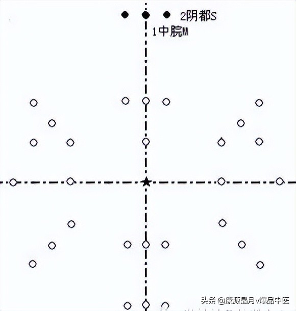 腹针疗法及16例常用处方