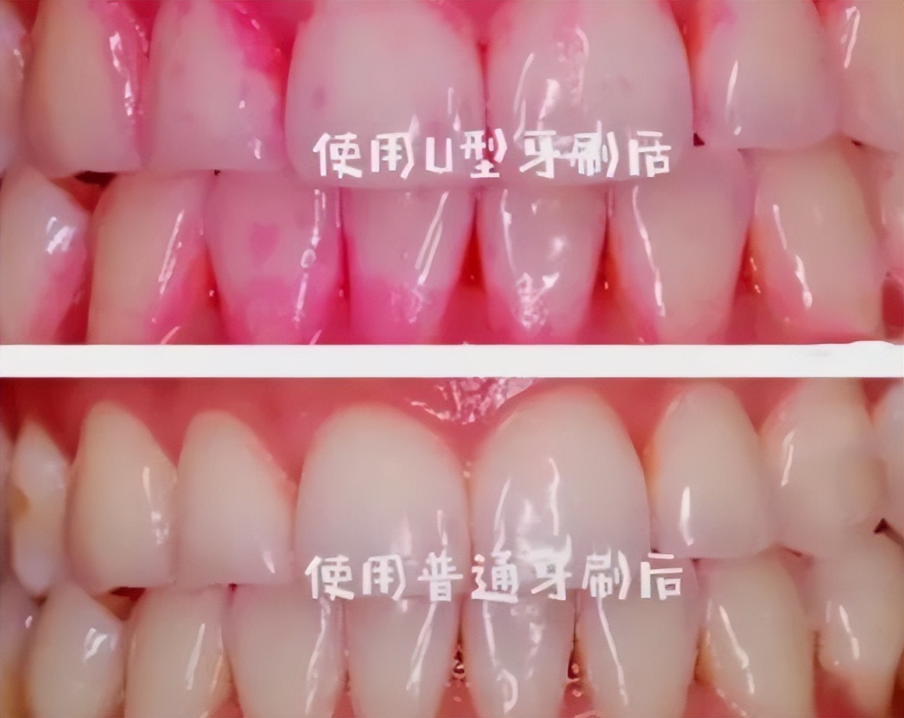 儿童电动牙刷排名第一名正品测评,徕芬2023电动牙刷