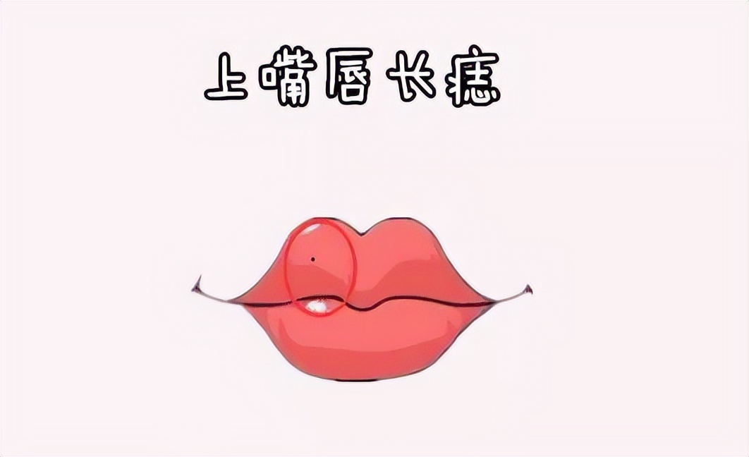 容易引起癌变的痣，需要警惕。