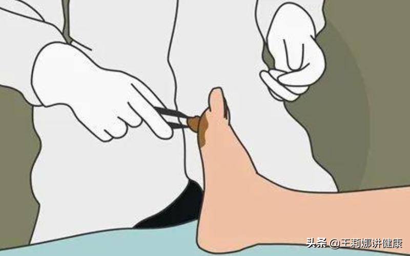 糖友怎样保护自己的肾,糖友如何预防糖尿病足