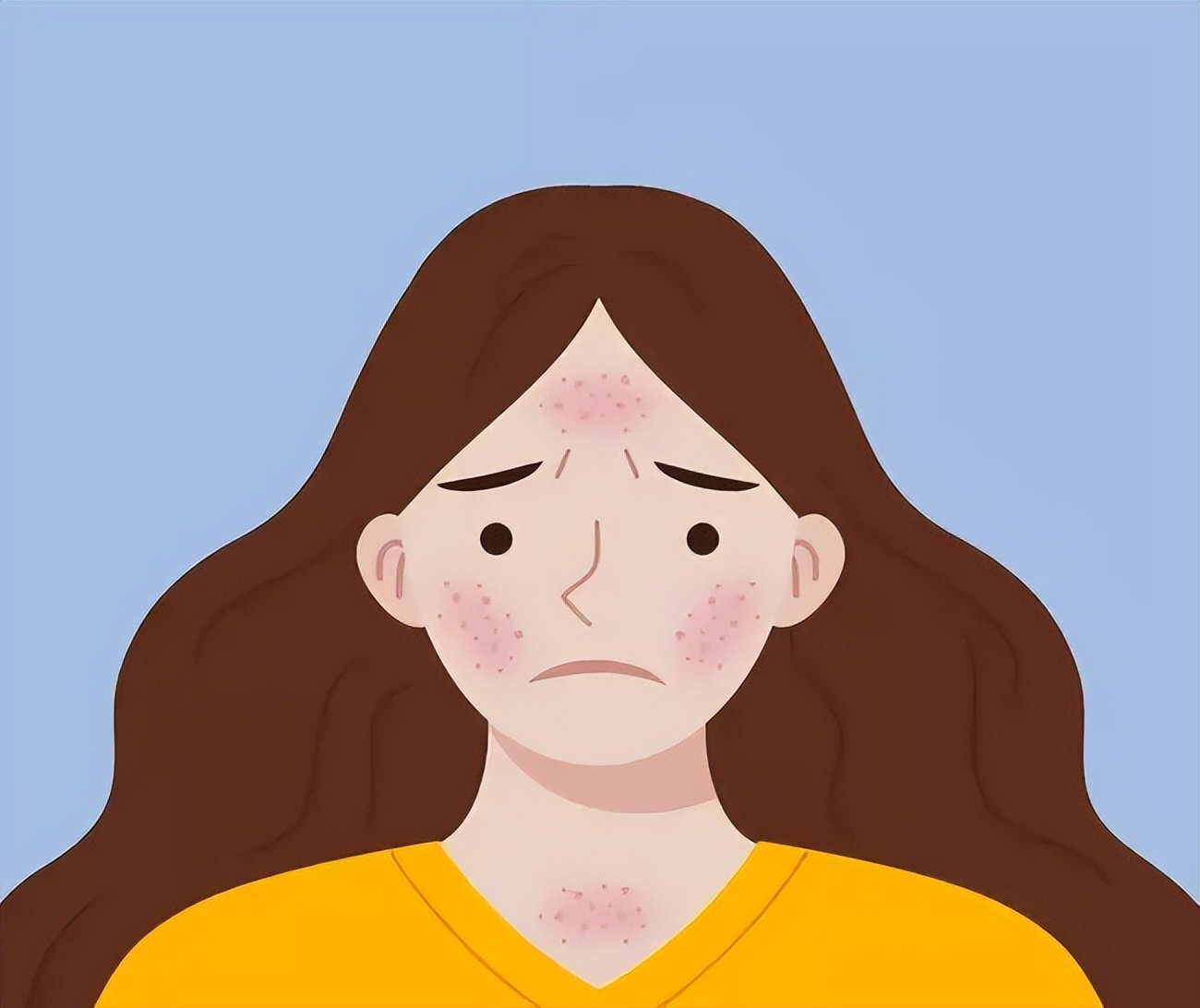 皮肤科专家提醒您：秋冬季节谨防“干性湿疹”