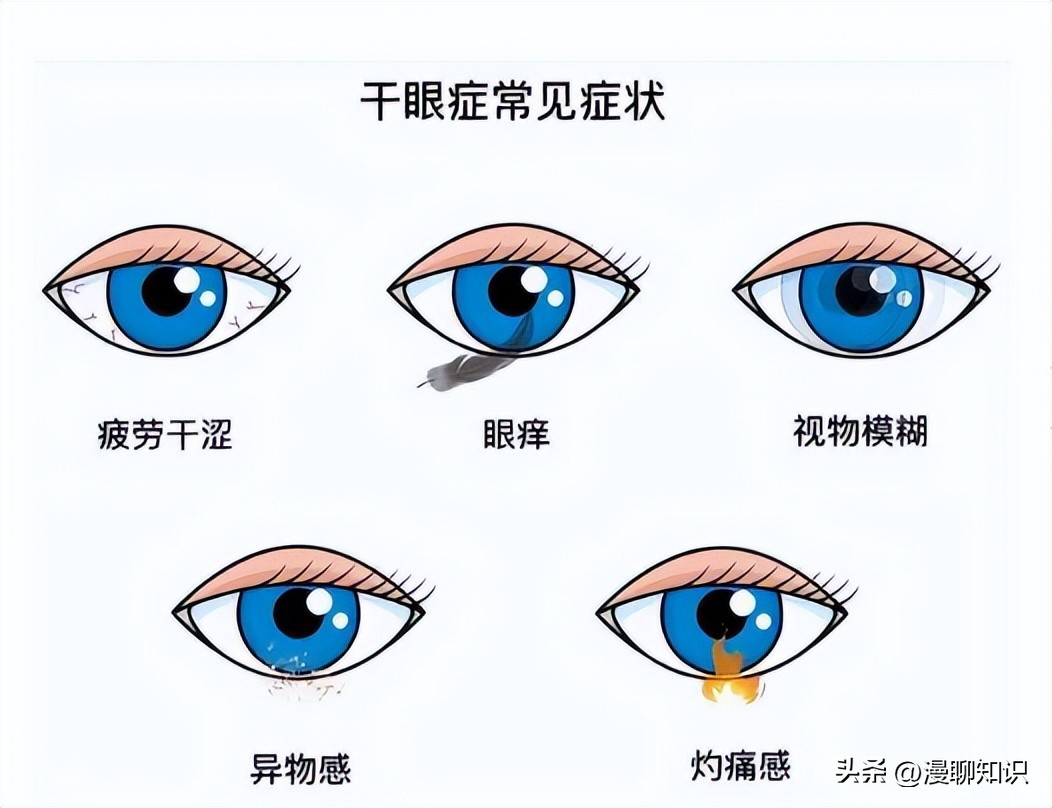 干眼就是干燥综合症吗,眼干涩视物模糊得了干眼怎么办