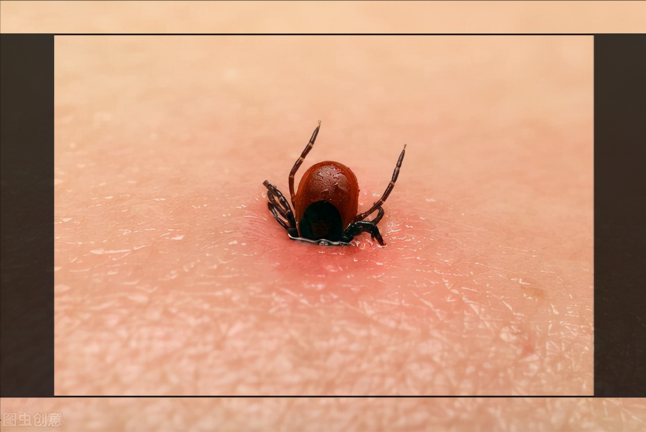 麻烦的狩猎者——小小蜱虫不可大意