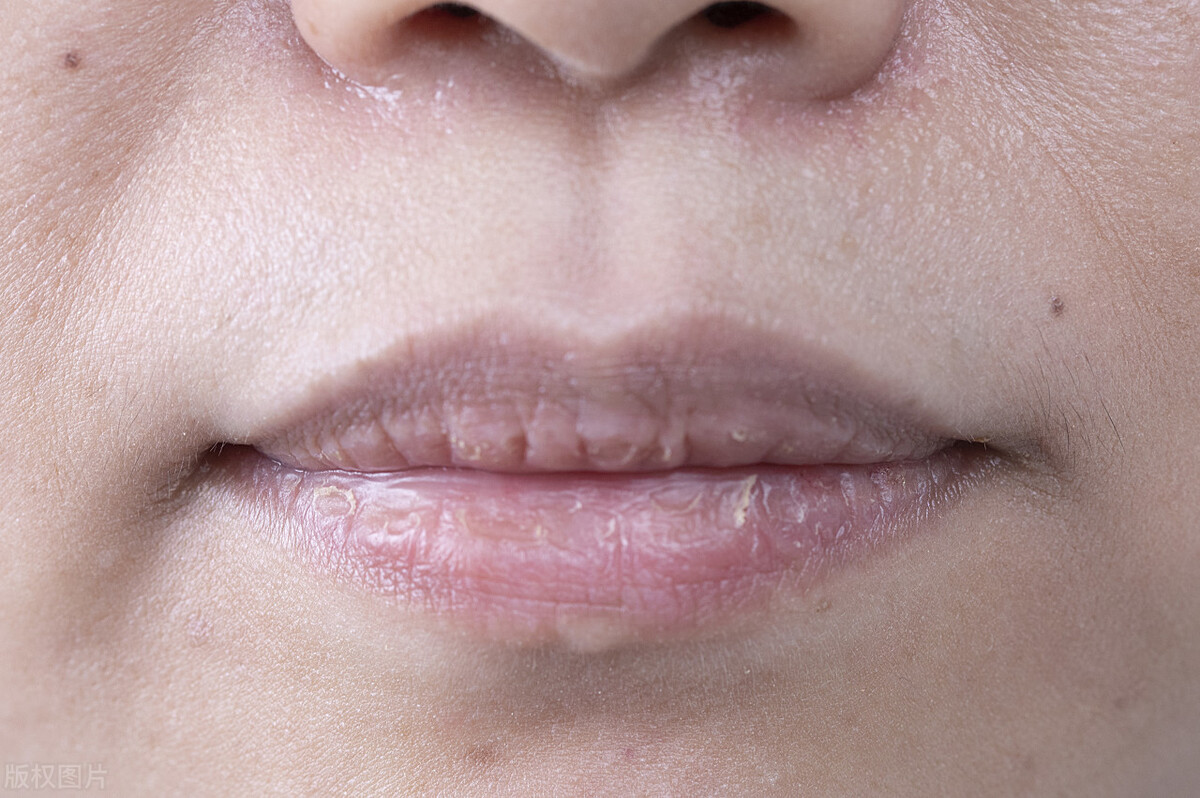 脾胃虚寒症状上吐下泻,大人上吐下泻吃什么食物好