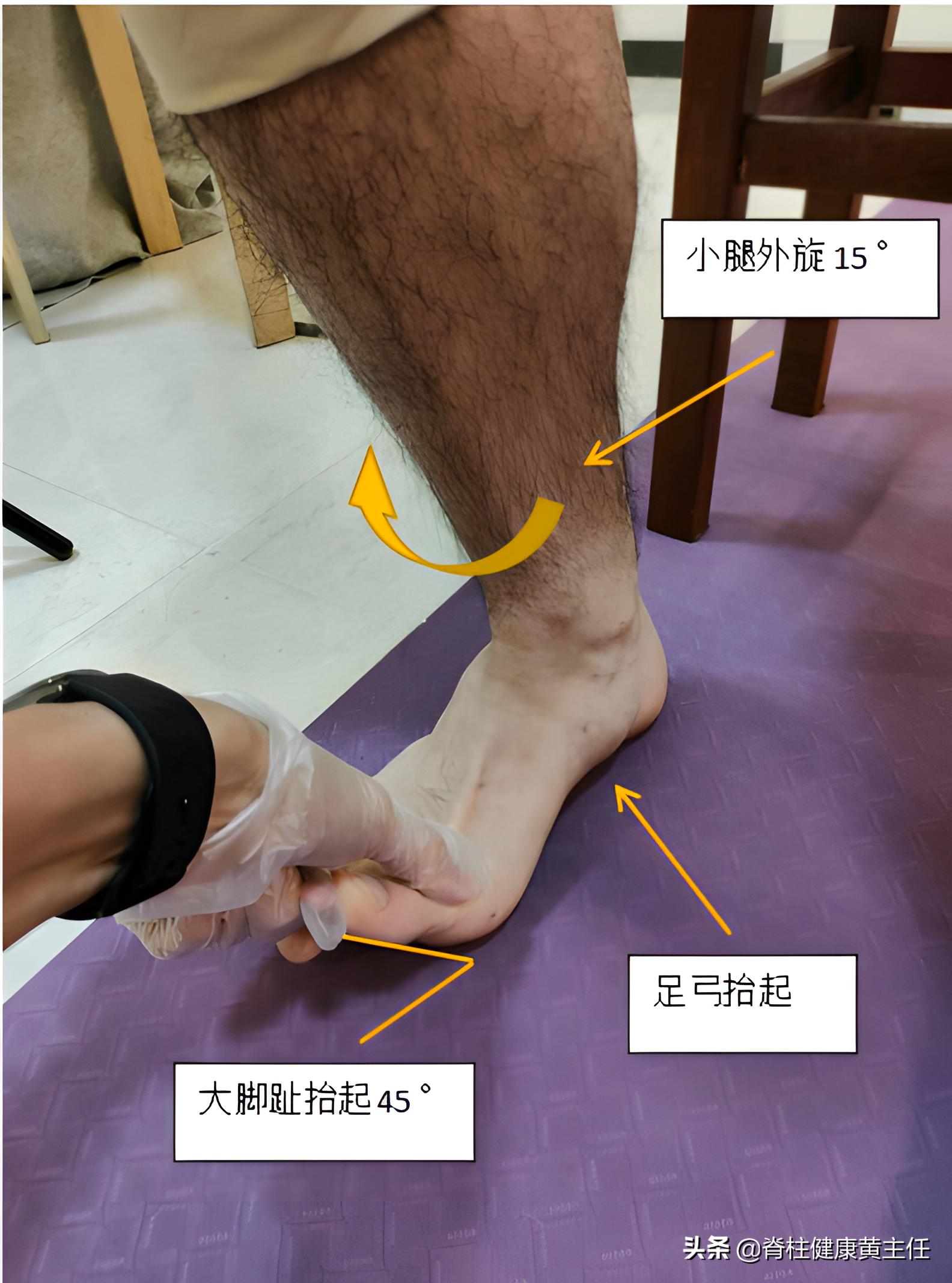 怎样判断自己有没有扁平足,怎么判断自己扁平足严不严重