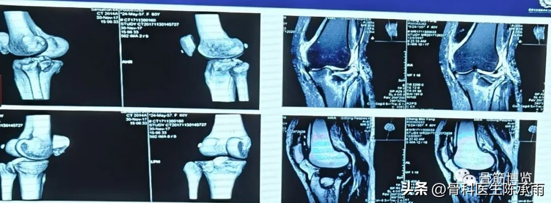 国家卫健委主办的骨创伤专项能力培训项目----下肢损伤学习班