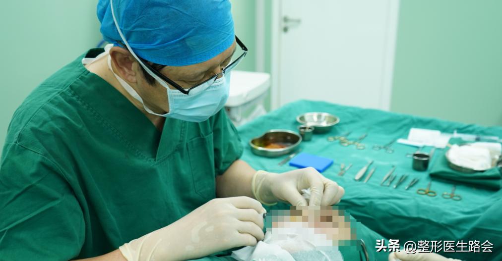 膨体隆鼻恢复期大揭秘,膨体隆鼻多年后真实感受