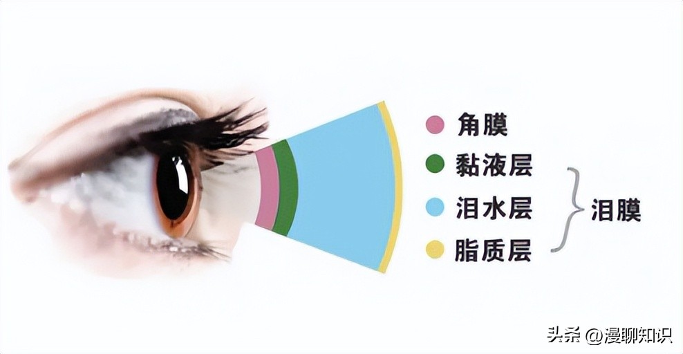 干眼就是干燥综合症吗,眼干涩视物模糊得了干眼怎么办