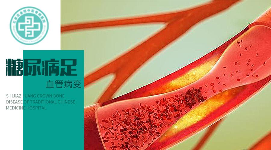 糖尿病开始烂脚了危险吗,糖尿病烂脚去哪家医院看