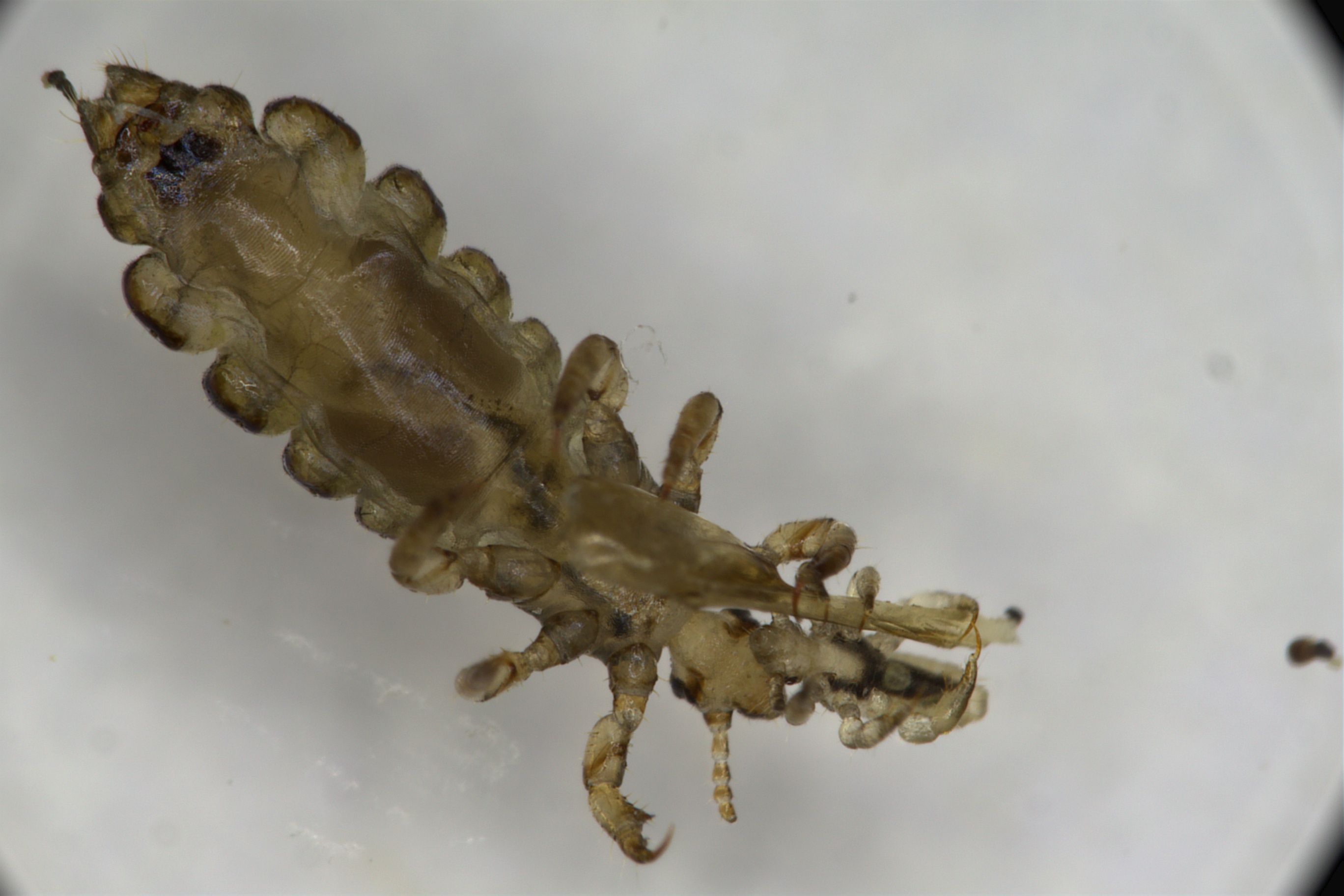 七岁孩子头发上怎么长虱子,小孩头发长头屑虱子