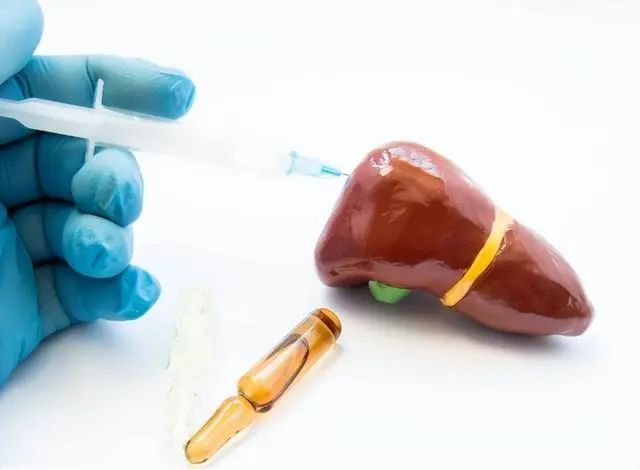 钇90微球治疗肝癌新技术,钇90微球注射液可治疗肝癌