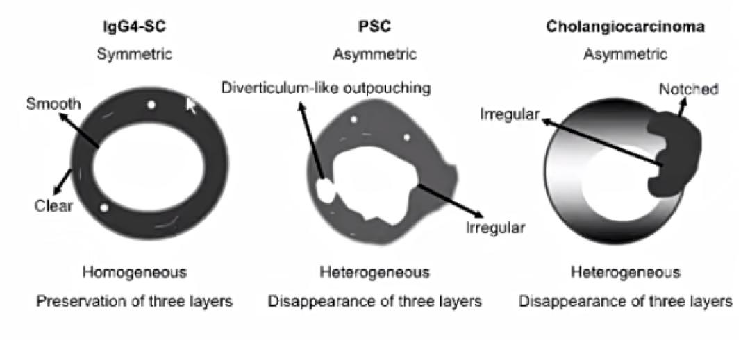 贾继东教授乙肝治愈主要药物,肝病专家贾继东抖音号