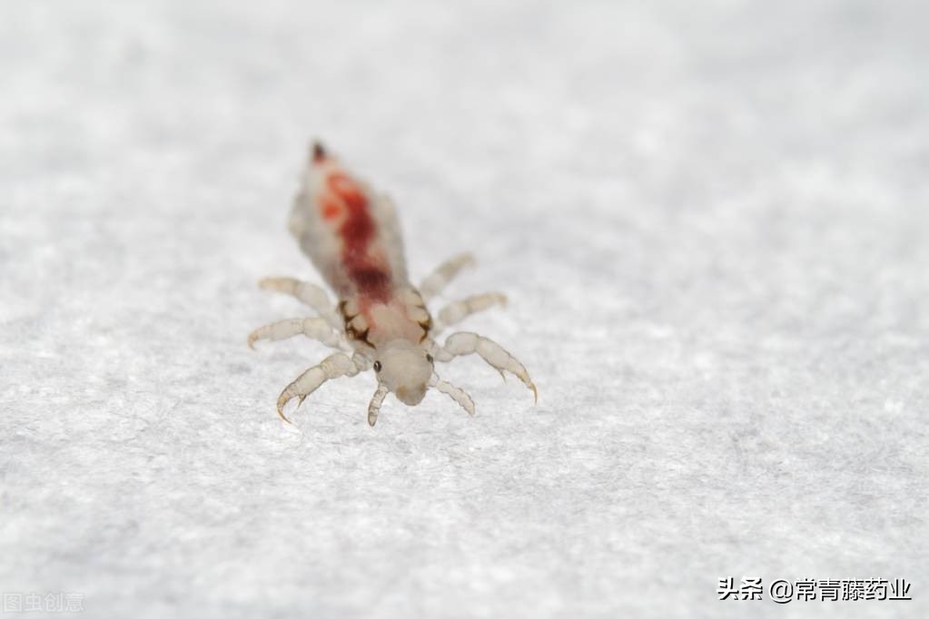 体虱和阴虱头虱的区别,头虱体虱阴虱怎么治疗