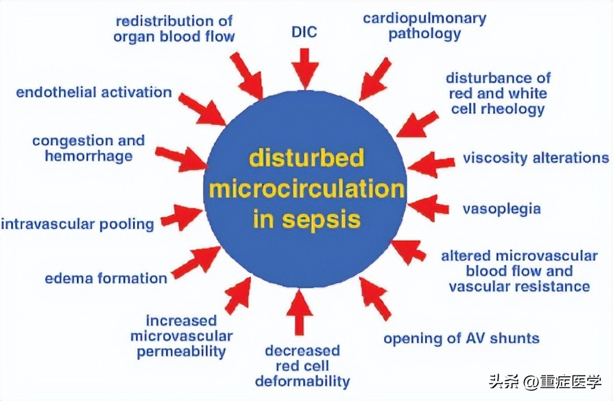 脓毒血症属于哪个系统疾病,脓毒症的快速识别