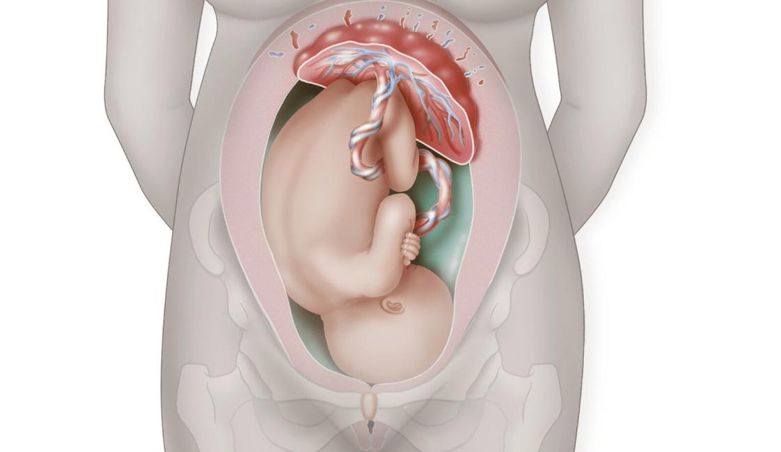 阴阳人是否确实存在,阴阳人既有精子也有卵子吗