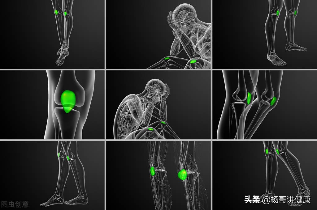 膝关节骨刺最新的治疗方法,膝关节长骨刺如何治疗与恢复