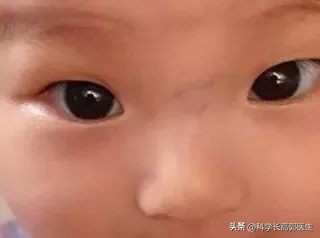 孩子咳嗽发烧反反复复是怎么回事,孩子咳嗽发烧的最佳治疗方法