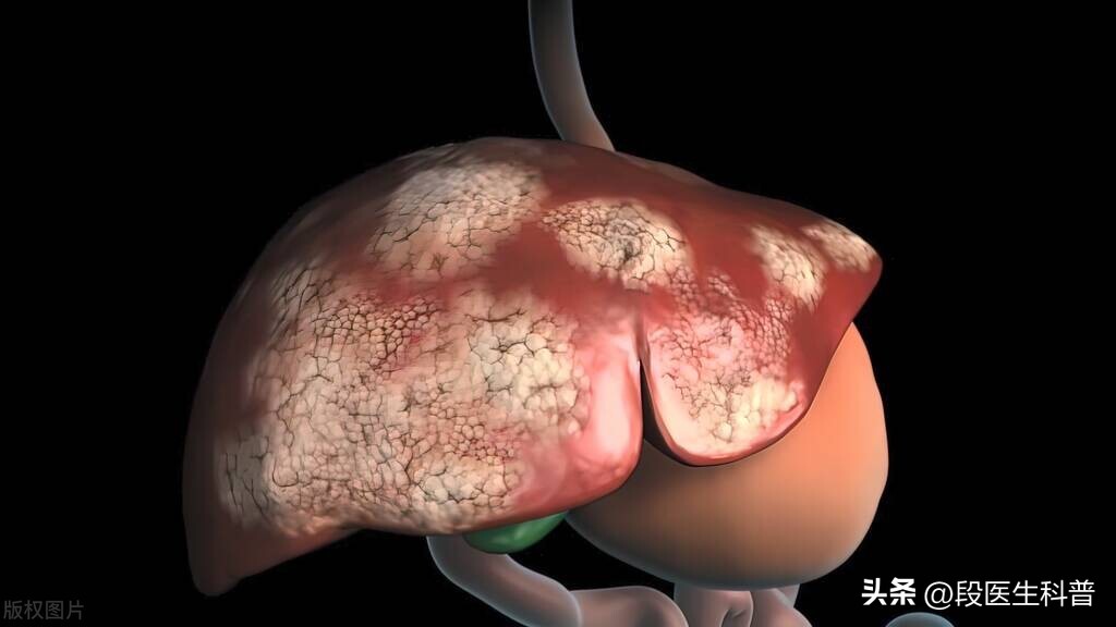 非感染性发热,感染性发热与非感染性发热的鉴别