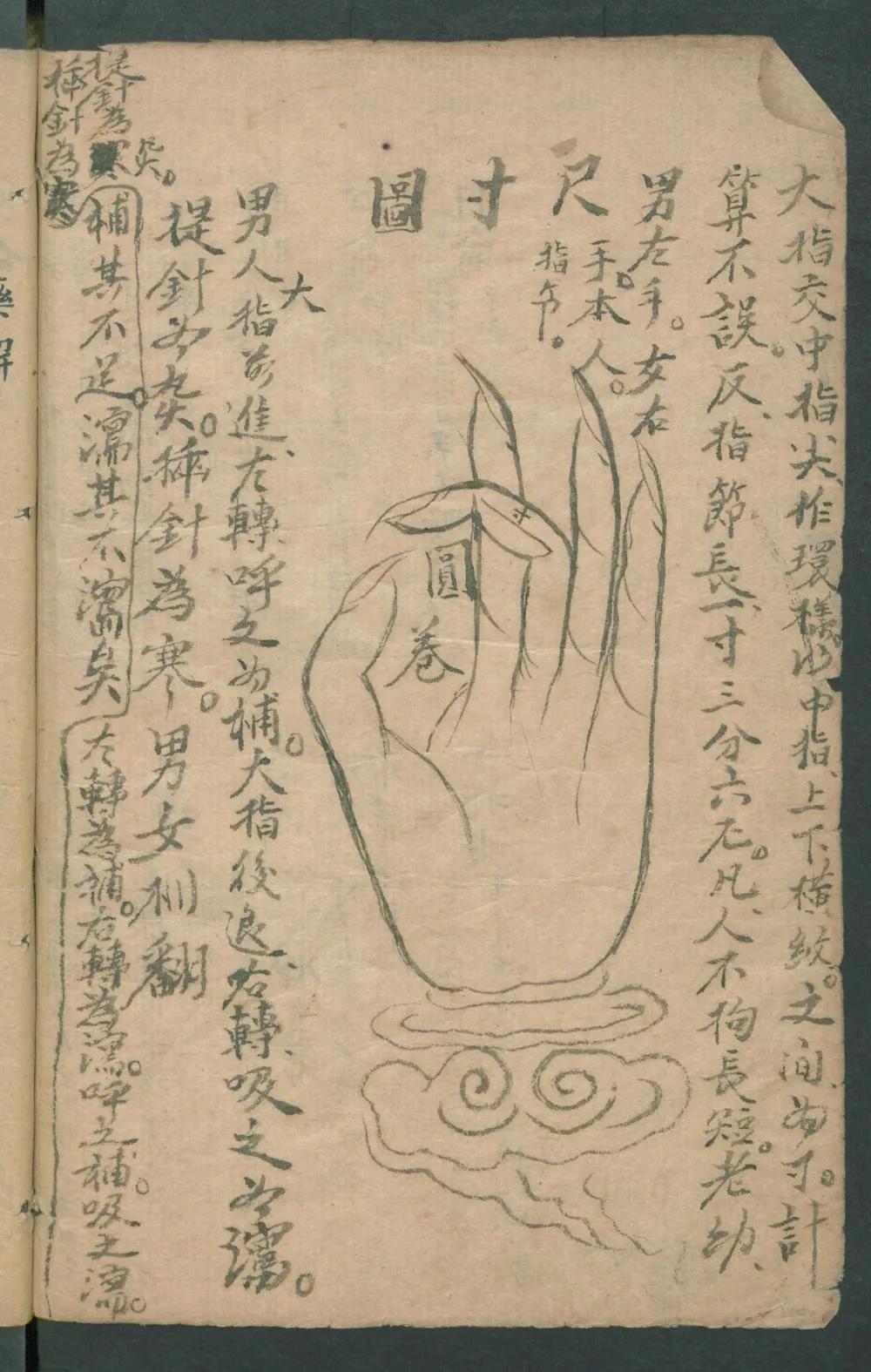 中医中药排痧的代表方剂,痧症秘传歌诀