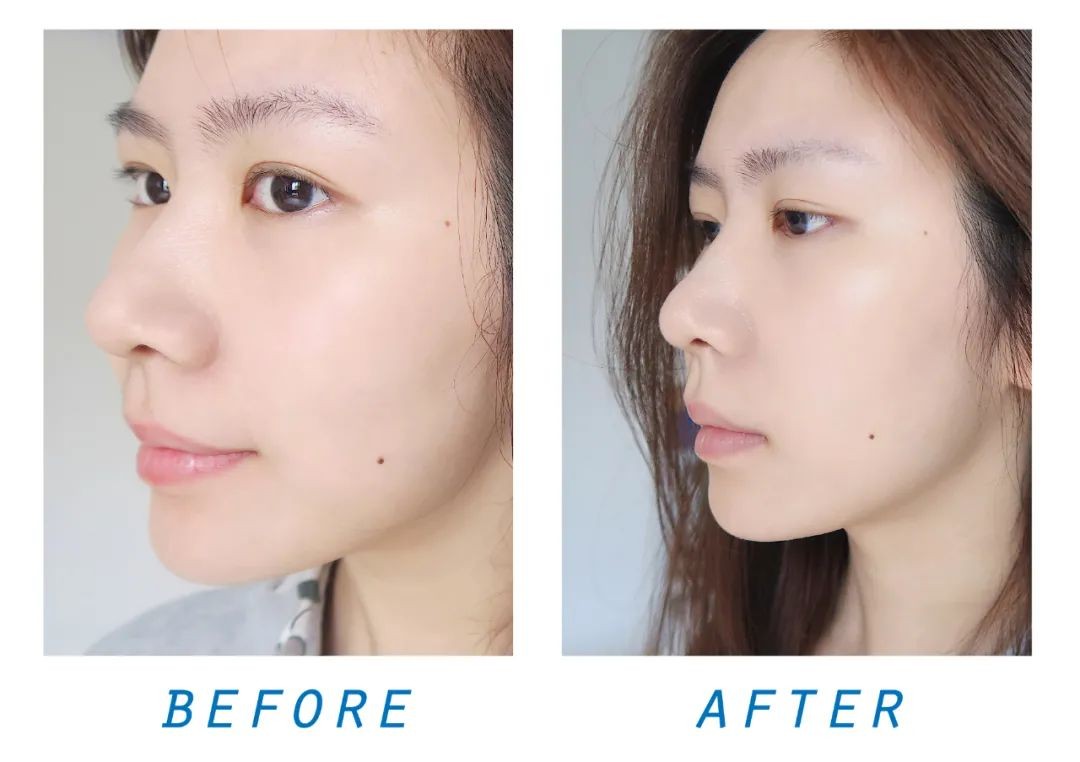 橒熙本草青春密码凝胶——把年龄当做秘密的女生最后都怎么样了？