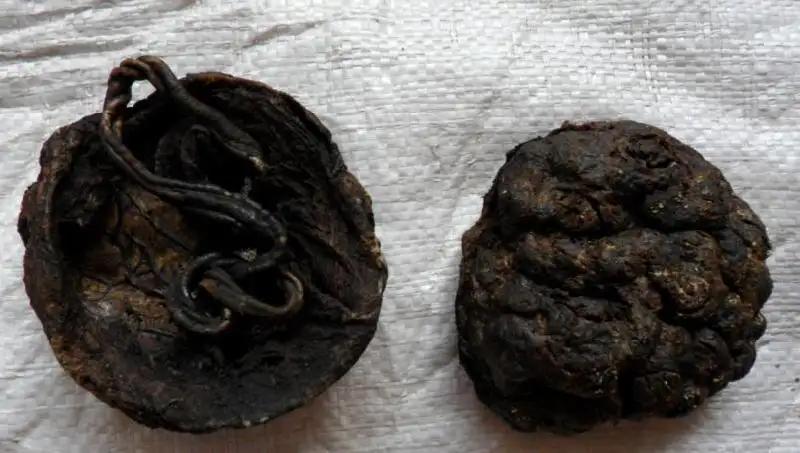 得了乳腺结节喝中药管事吗,有乳腺结节可以喝茶吗