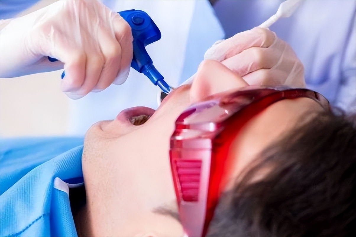 洗牙会伤害牙齿吗该不该洗牙,深度洗牙对牙齿有伤害吗