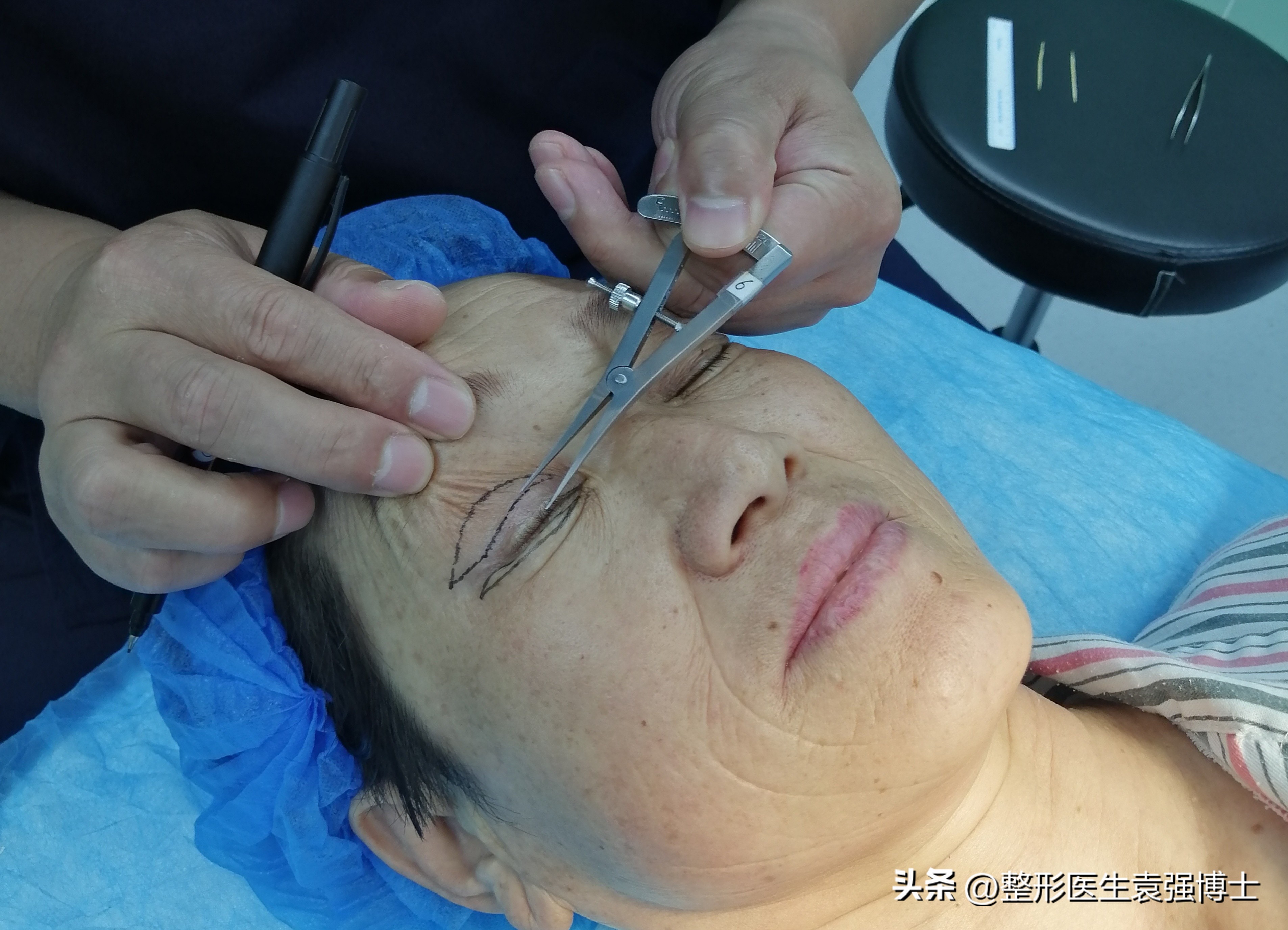 上眼皮松下垂该怎么办,上眼皮松弛耷拉怎么办