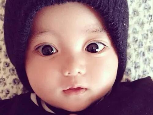 为什么新生儿都是单眼皮,新生儿出生是单眼皮会变双眼皮吗