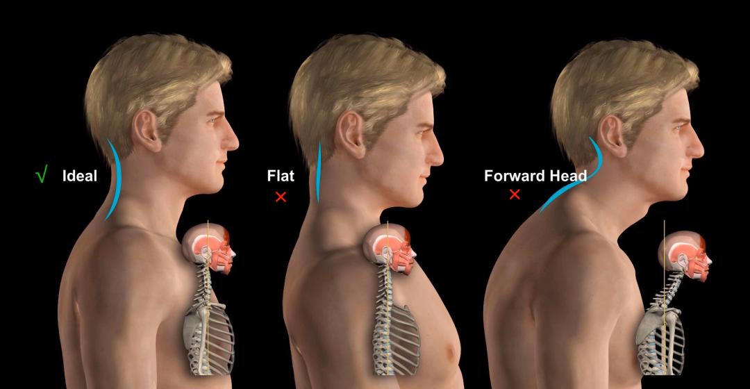 改善圆肩驼背的瑜伽体式,改善圆肩驼背的健身动作