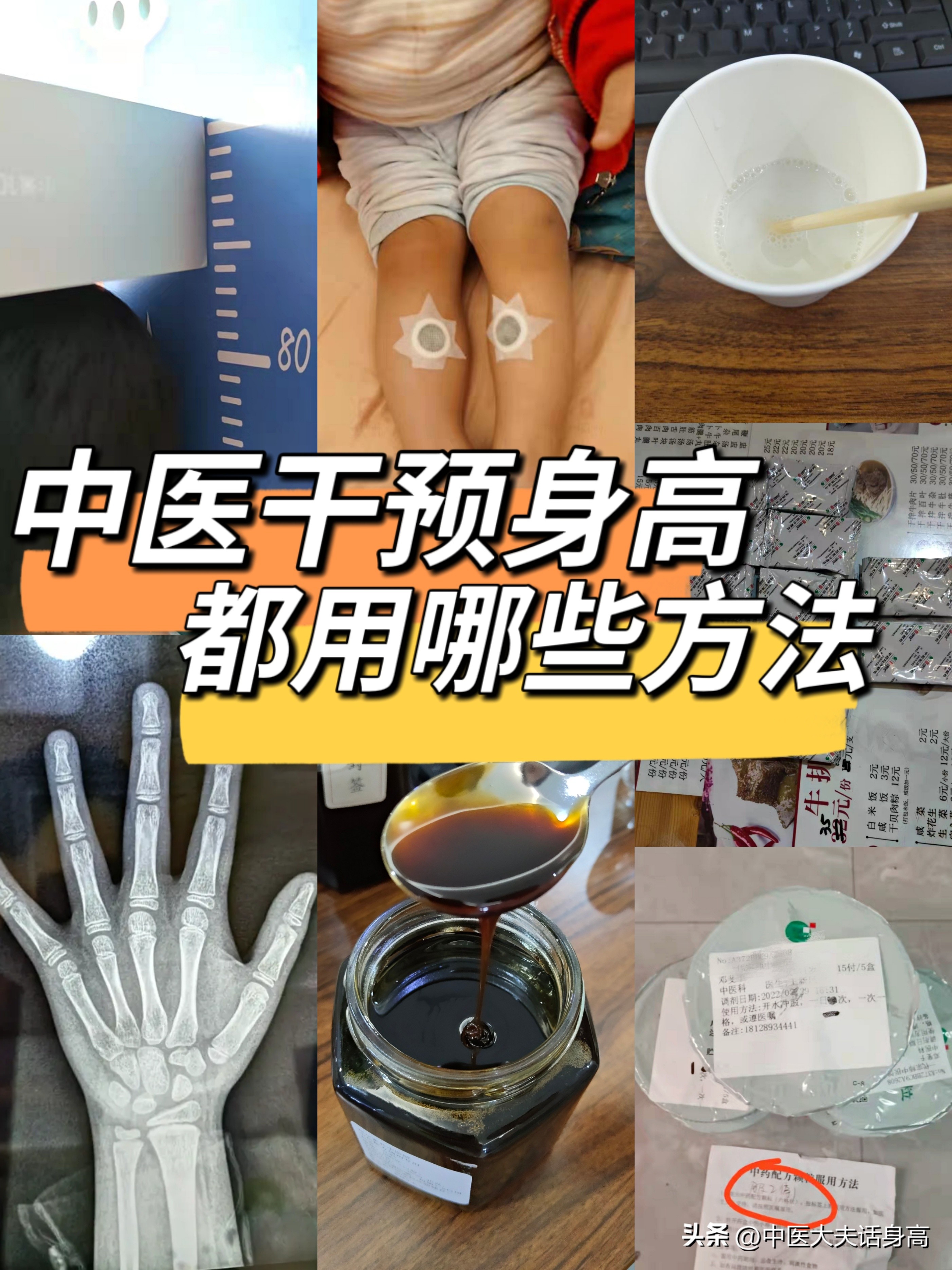 孩子生长激素缺乏，必须要打生长激素吗？现在又有了新方法