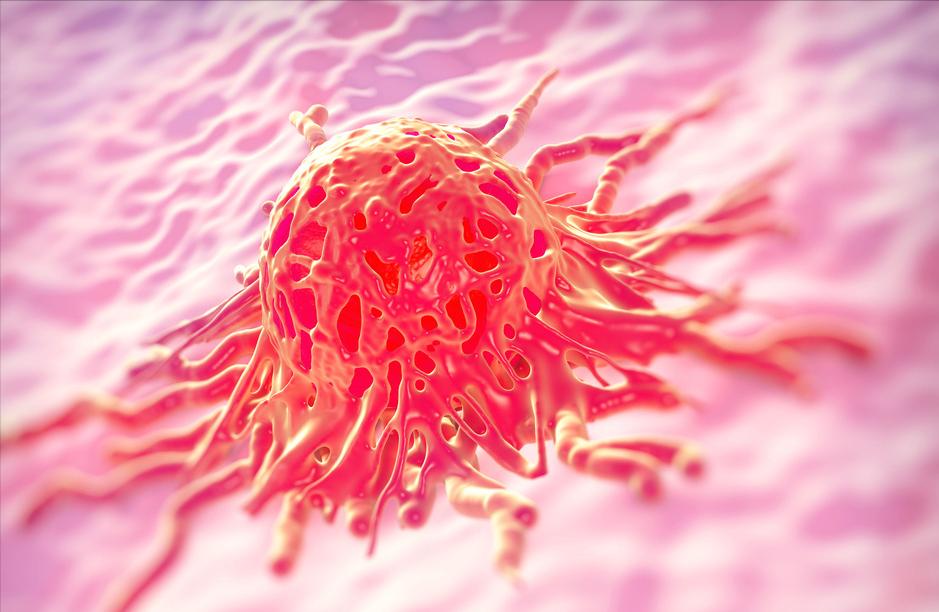 经常腿痛是不是宫颈癌,55岁女子长期腿痛查出宫颈癌