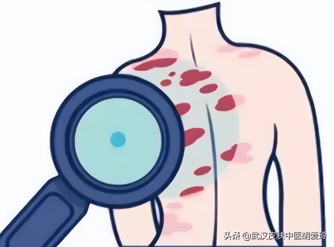 脸上有块皮肤发红反复脱皮,眉毛皮肤发红脱皮怎么回事