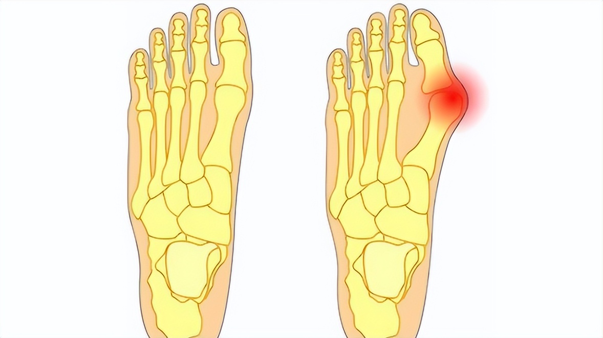 脚底板爱紫是什么原因,脚底板爱起皮是怎么回事
