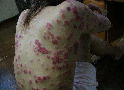 “强的松”功能强大，价格便宜，为什么人们对它却很忌讳