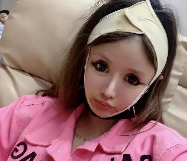 整容狂人整容100多次,整容狂魔手术200次