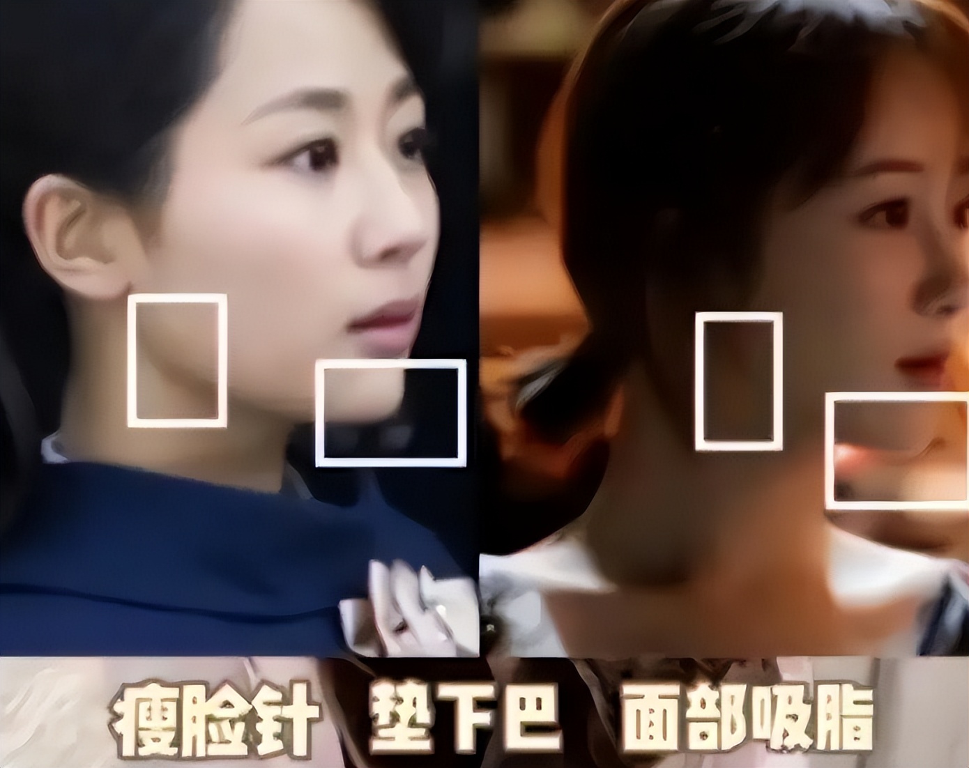 有一种倔强叫我没整容,有种倔强叫没整过容