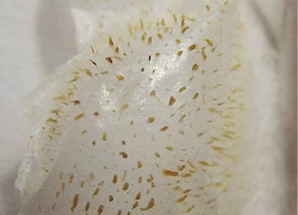 鼻子的黑头跟草莓一样,草莓黑头怎么去除最有效