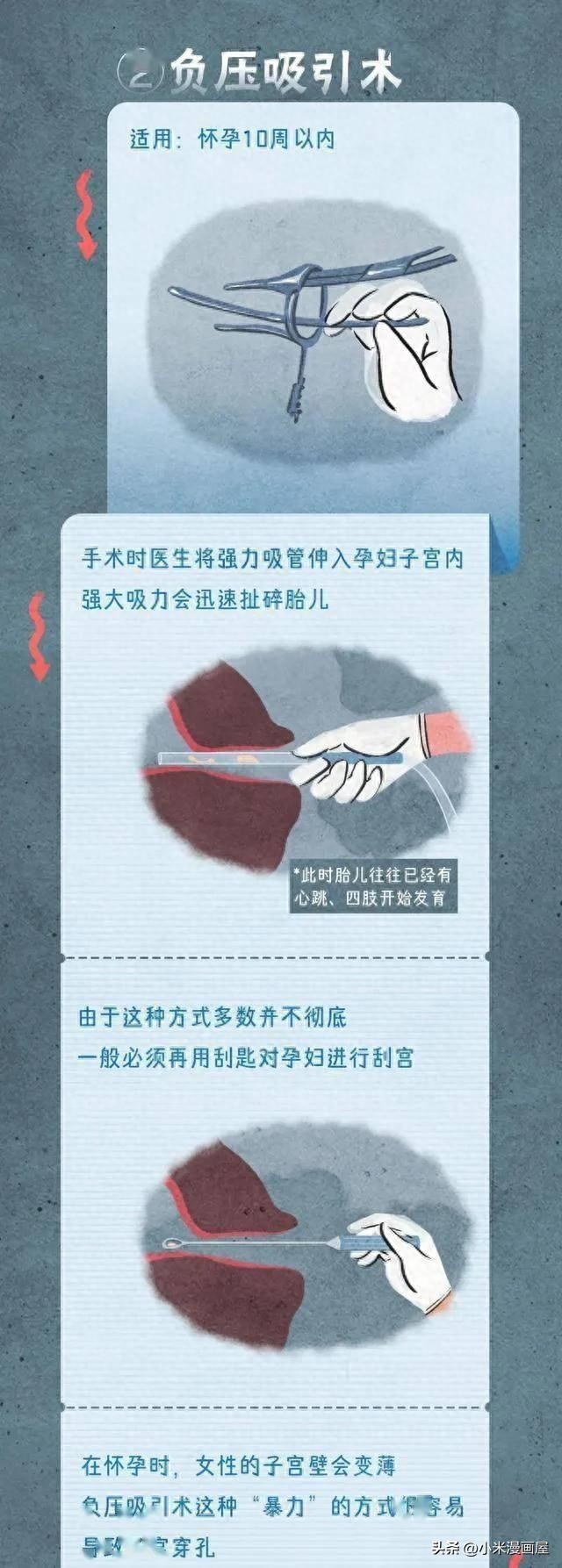 “擦边*行为性**”会不会怀孕？该如何正确避孕呢？漫画