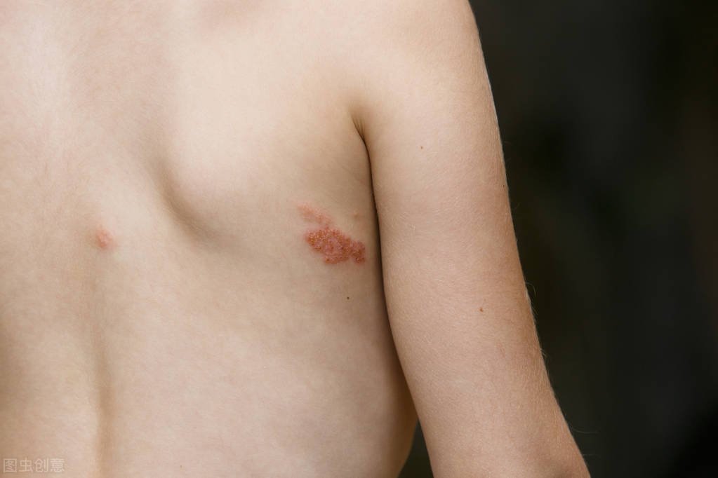 66岁老年人胸痛,60岁的胸痛