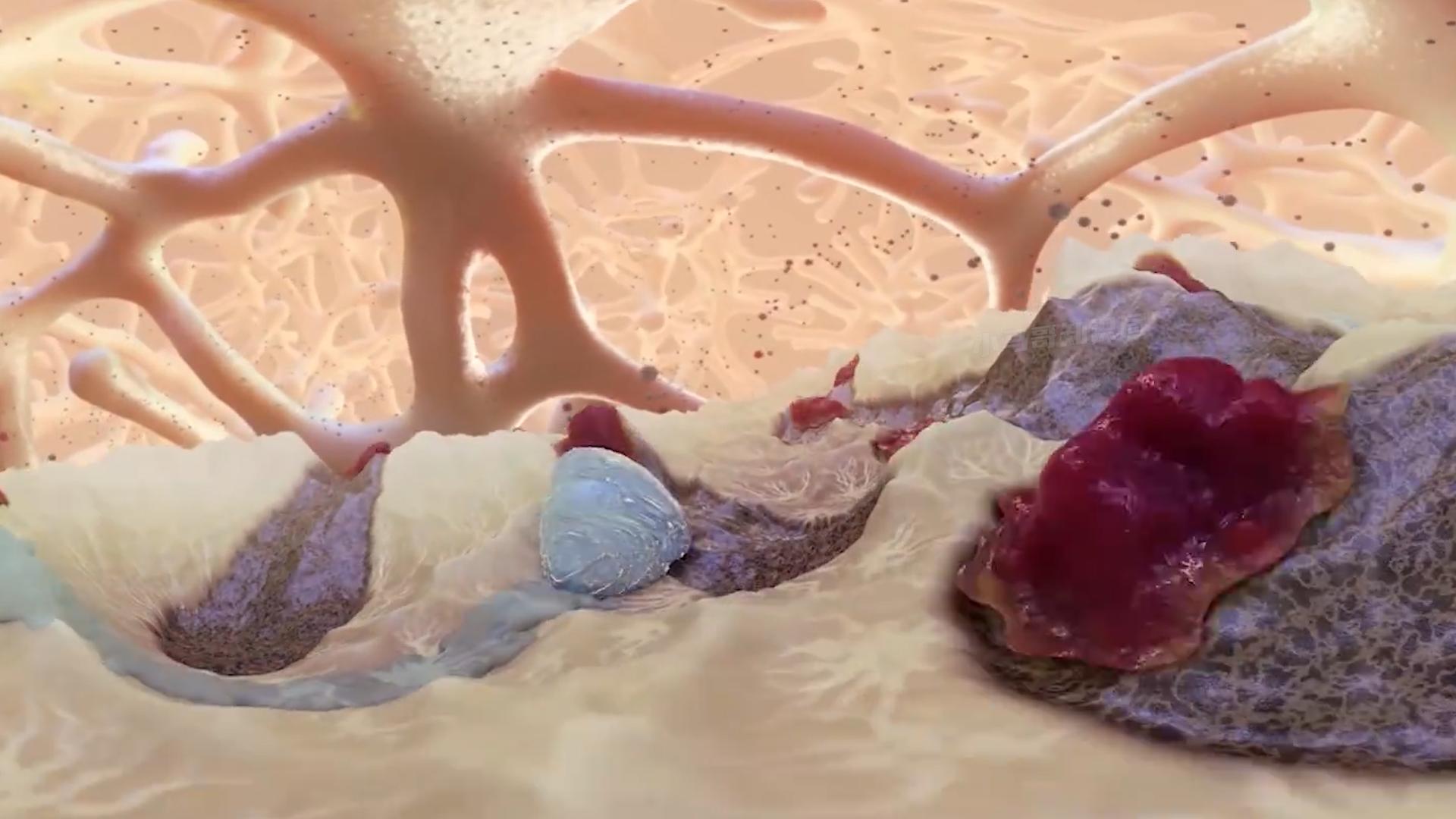 甲鱼冷冻多久可以复活,冰冻的一个月的甲鱼能否复活