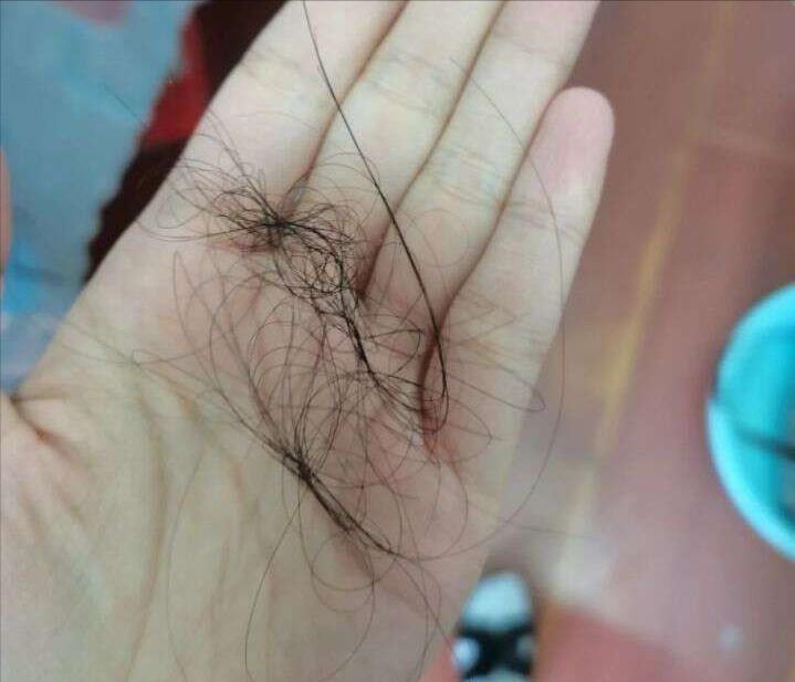 有效的防掉防脱洗发水,什么防脱洗发水适合干性头发用