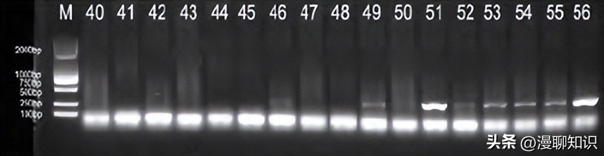 猫会感染人的疾病的图片,猫病毒检测cpr可以测出什么病毒