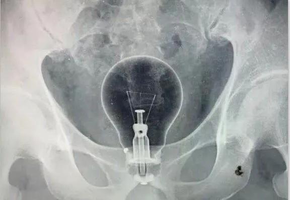 「医界趣闻」肛肠科那些事儿