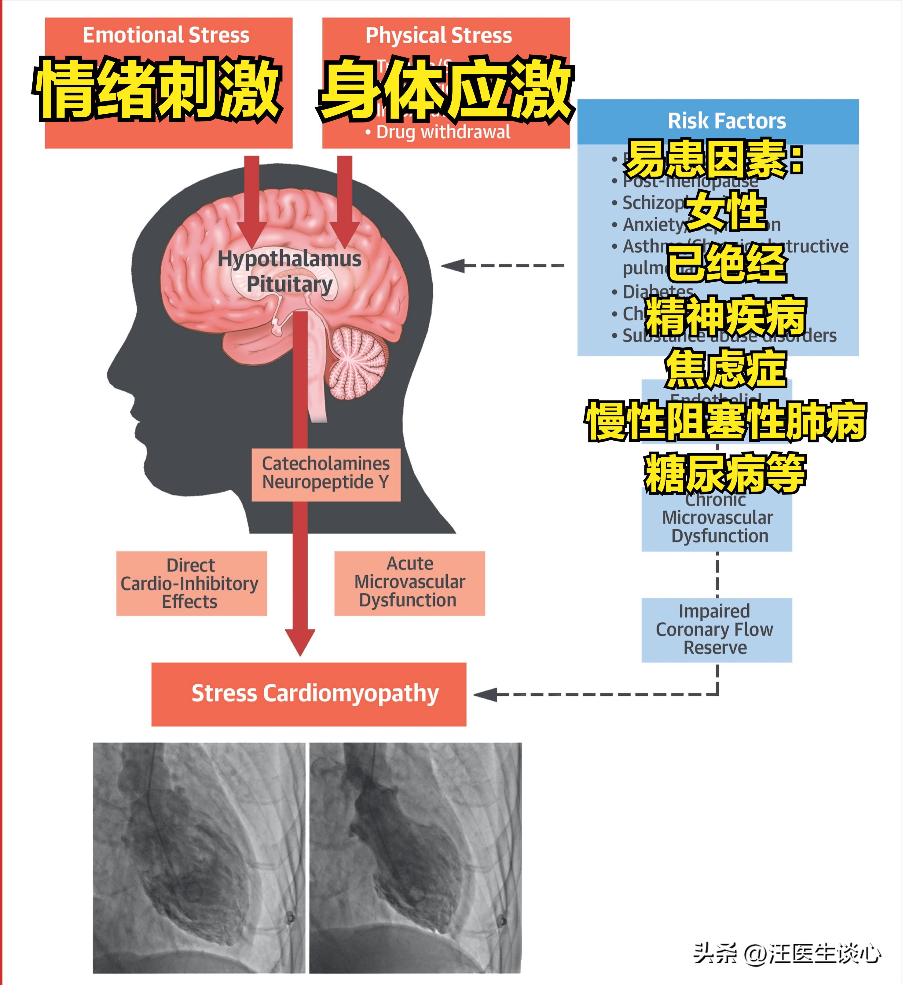 情绪激动也会“心碎”？