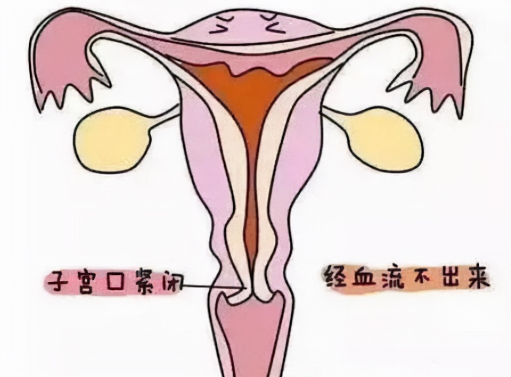 经期会阴有坠痛感是什么原因,来月经站着下身有点痛感怎么缓解