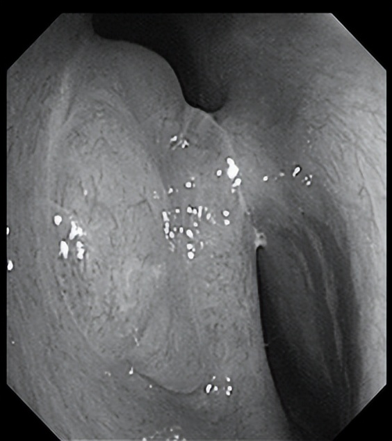 南昌二附院耳鼻喉科手术,南昌大学第二附属医院耳鼻咽喉科