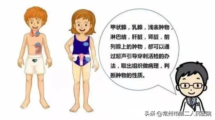 小针孔，用途多，漫画带你了解介入超声能做啥？