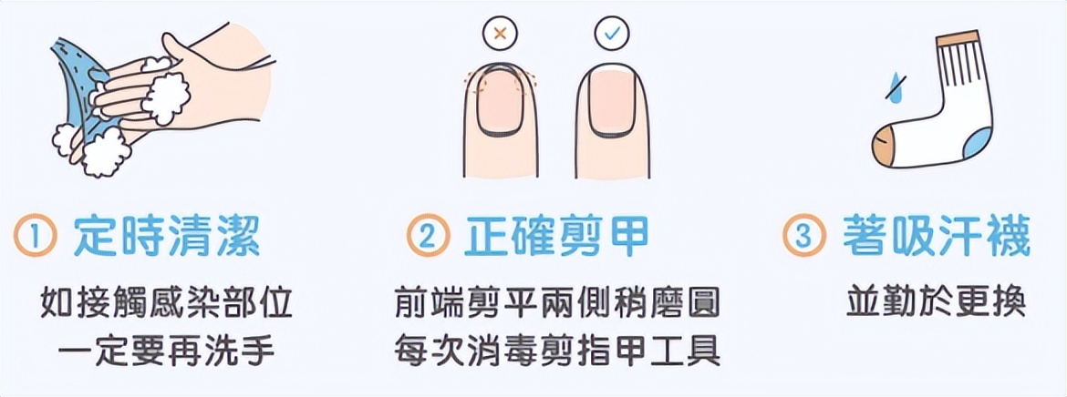 怎样避免灰指甲传染给孩子,灰指甲容易传染给别人吗