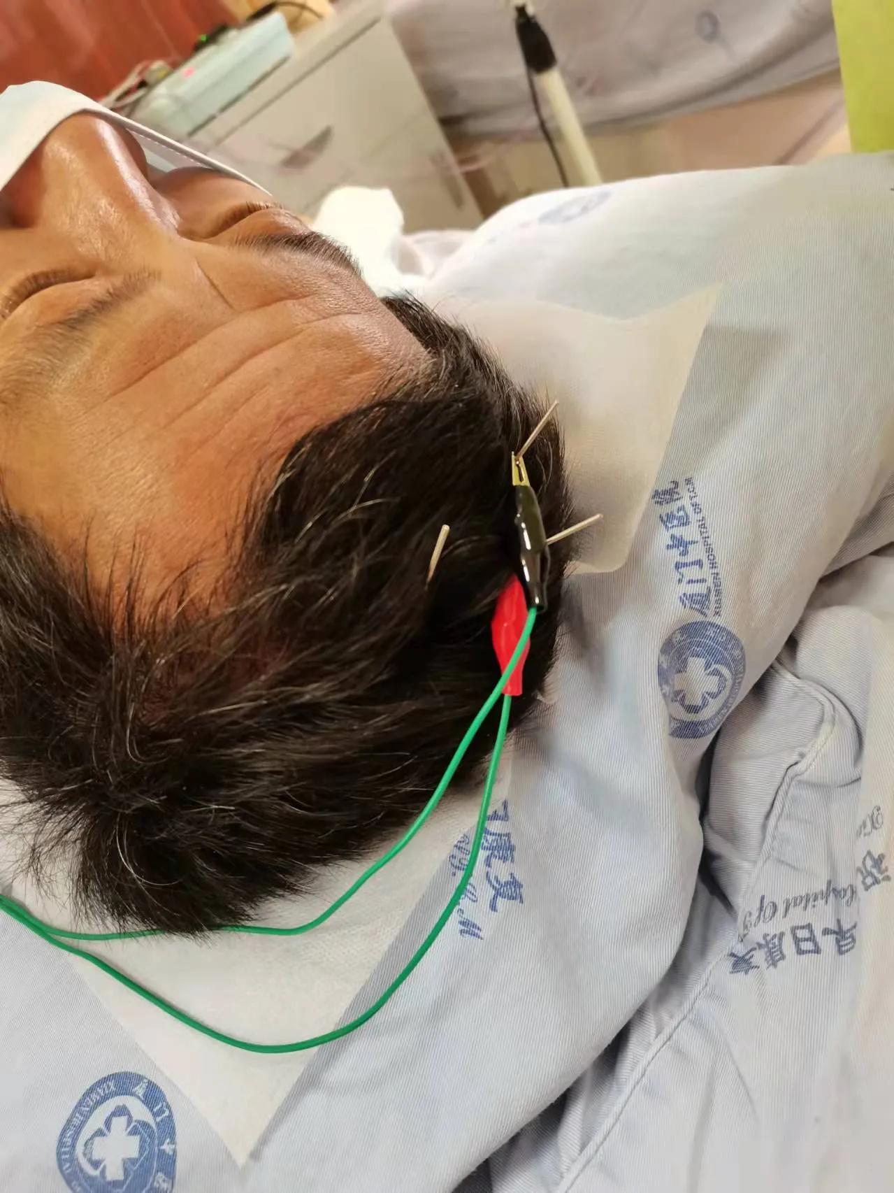 一例脑梗死病人的康复,脑梗偏瘫康复之路