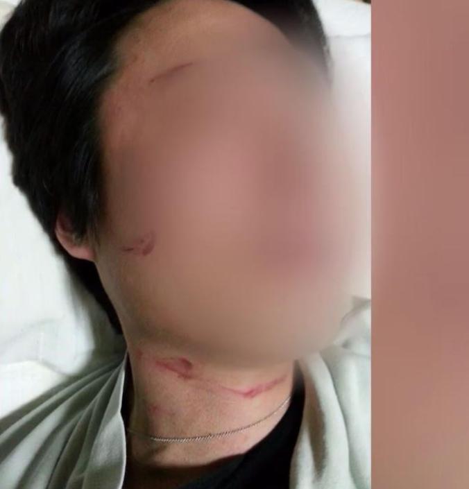 赵显娥家暴事件,赵显娥家暴赔了多少